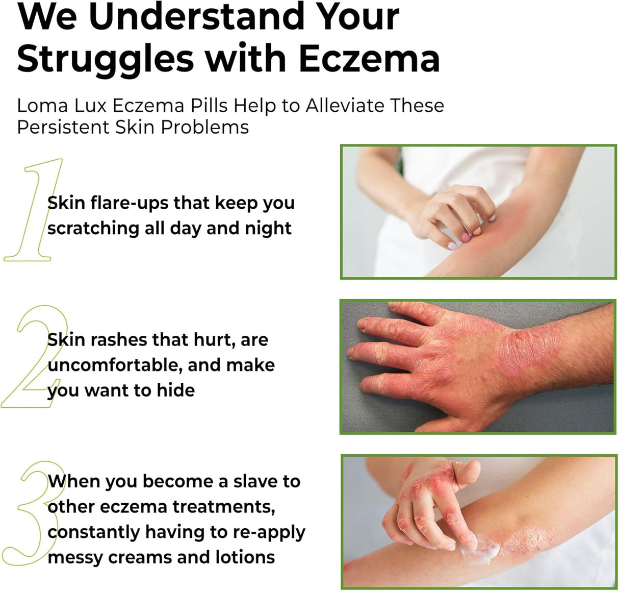 Advertisement for Loma Lux Eczema Pills showing symptoms and relief from eczema.