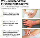 Advertisement for Loma Lux Eczema Pills showing symptoms and relief from eczema.