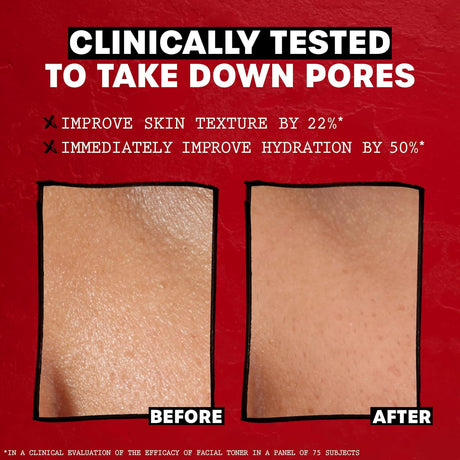 Thayers Witch Hazel Rose Petal Hydrating Face Toner for Sensitive Skin, 3 fl oz (Pack of 12)